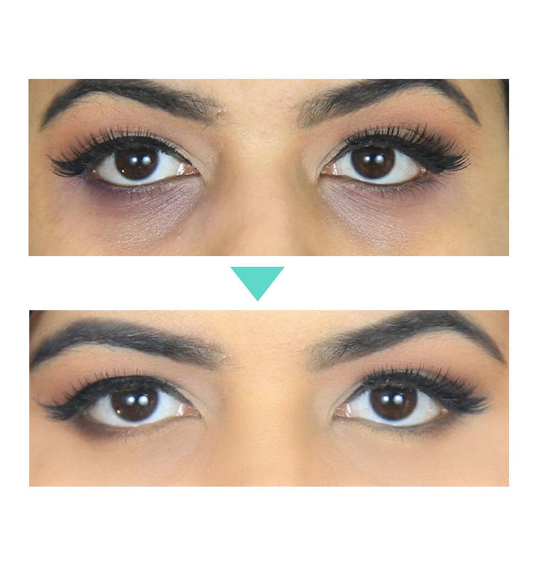 Anti- Wrinkle Eye Treatment