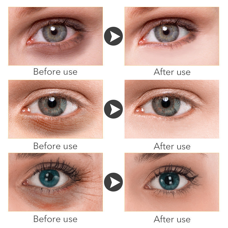 Anti- Wrinkle Eye Treatment